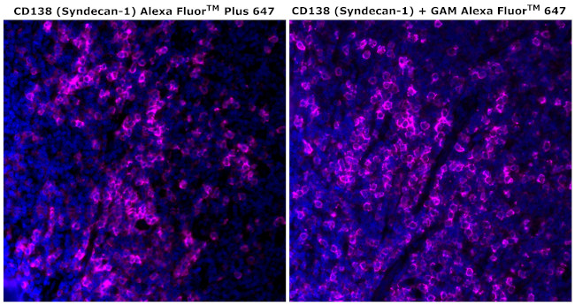 CD138 Antibody in Immunohistochemistry (Paraffin) (IHC (P))