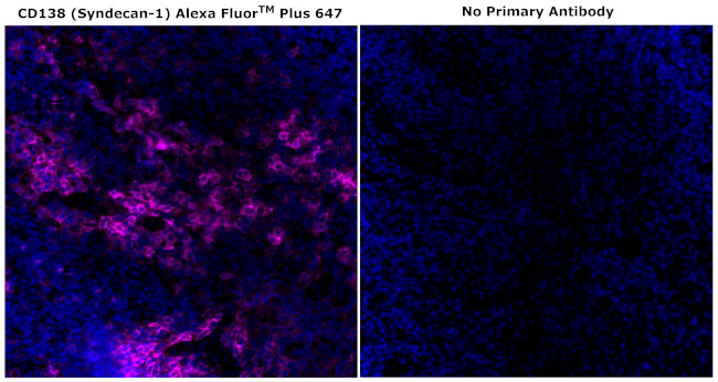 CD138 Antibody in Immunohistochemistry (Paraffin) (IHC (P))