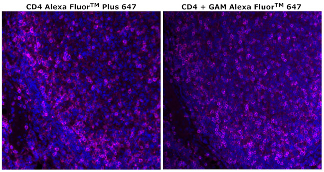 CD4 Antibody in Immunohistochemistry (Paraffin) (IHC (P))