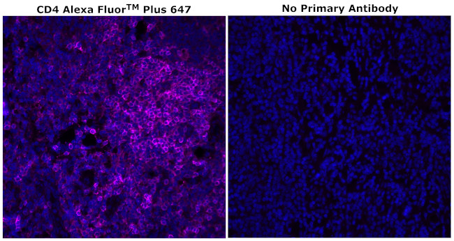 CD4 Antibody in Immunohistochemistry (Paraffin) (IHC (P))