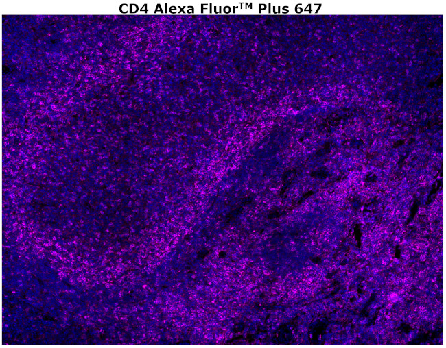 CD4 Antibody in Immunohistochemistry (Paraffin) (IHC (P))