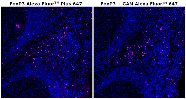 FOXP3 Antibody in Immunohistochemistry (Paraffin) (IHC (P))