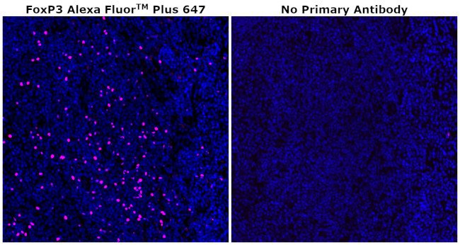 FOXP3 Antibody in Immunohistochemistry (Paraffin) (IHC (P))