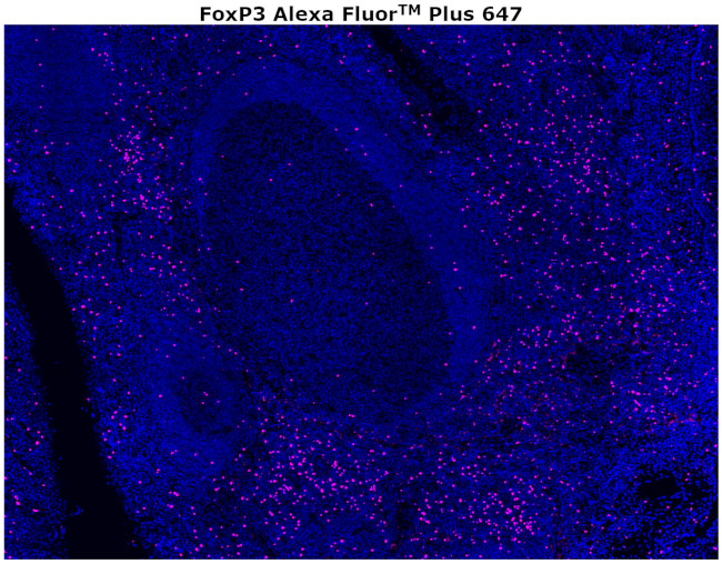 FOXP3 Antibody in Immunohistochemistry (Paraffin) (IHC (P))