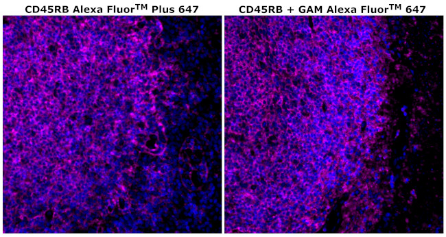 CD45RB Antibody in Immunohistochemistry (Paraffin) (IHC (P))