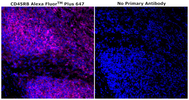 CD45RB Antibody in Immunohistochemistry (Paraffin) (IHC (P))