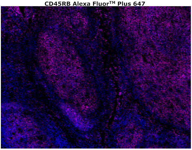 CD45RB Antibody in Immunohistochemistry (Paraffin) (IHC (P))