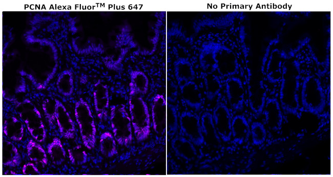 PCNA Antibody in Immunohistochemistry (Paraffin) (IHC (P))