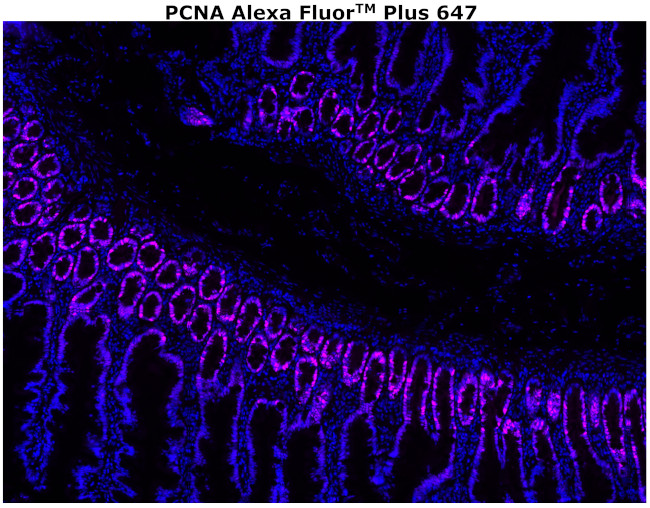 PCNA Antibody in Immunohistochemistry (Paraffin) (IHC (P))