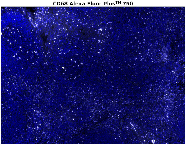 CD68 Antibody in Immunohistochemistry (Paraffin) (IHC (P))