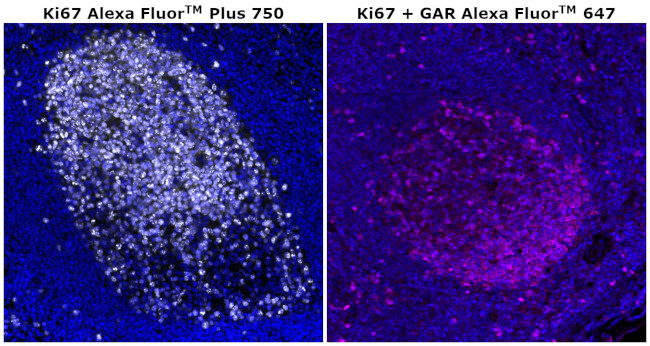 Ki-67 Antibody in Immunohistochemistry (Paraffin) (IHC (P))