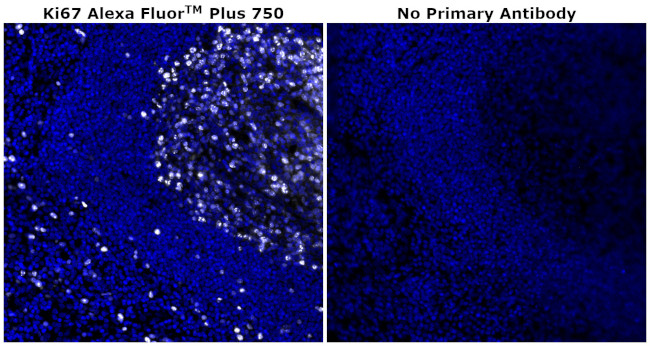 Ki-67 Antibody in Immunohistochemistry (Paraffin) (IHC (P))