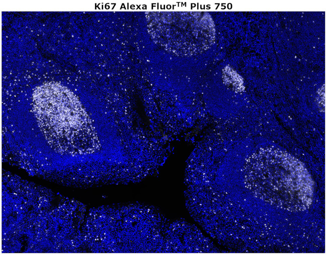 Ki-67 Antibody in Immunohistochemistry (Paraffin) (IHC (P))