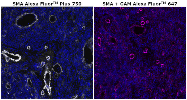 Alpha-Smooth Muscle Actin Antibody in Immunohistochemistry (Paraffin) (IHC (P))