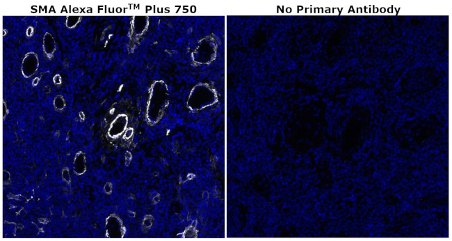 Alpha-Smooth Muscle Actin Antibody in Immunohistochemistry (Paraffin) (IHC (P))