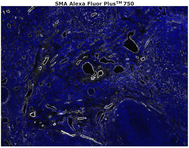 Alpha-Smooth Muscle Actin Antibody in Immunohistochemistry (Paraffin) (IHC (P))