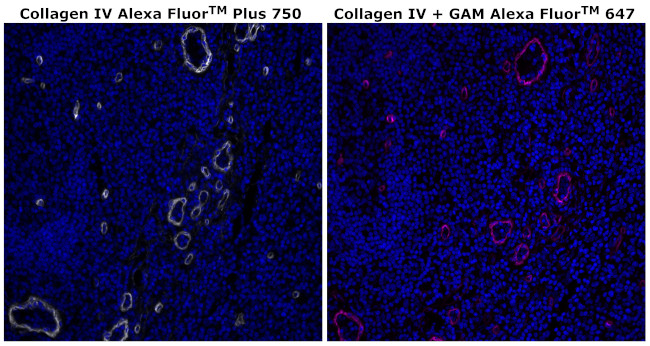 Collagen IV Antibody in Immunohistochemistry (Paraffin) (IHC (P))