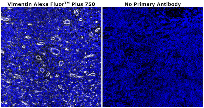 Vimentin Antibody in Immunohistochemistry (Paraffin) (IHC (P))