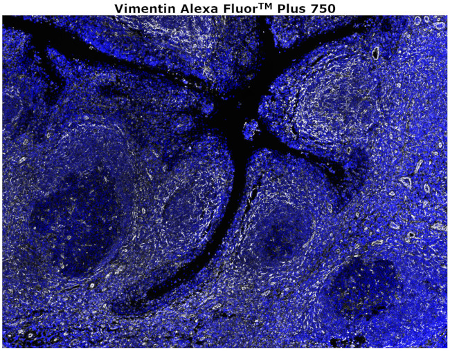 Vimentin Antibody in Immunohistochemistry (Paraffin) (IHC (P))