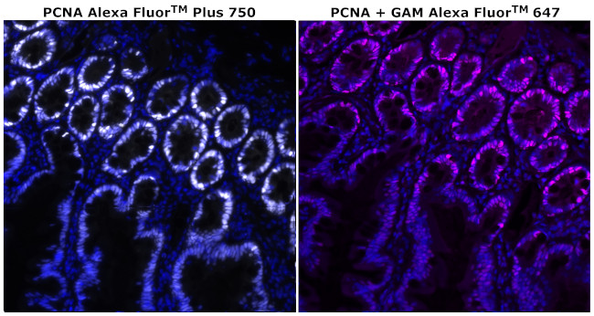 PCNA Antibody in Immunohistochemistry (Paraffin) (IHC (P))