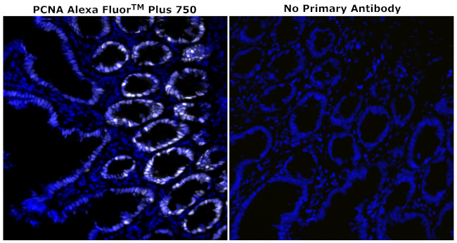 PCNA Antibody in Immunohistochemistry (Paraffin) (IHC (P))