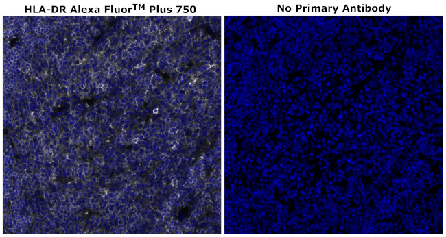 HLA-DR Antibody in Immunohistochemistry (Paraffin) (IHC (P))