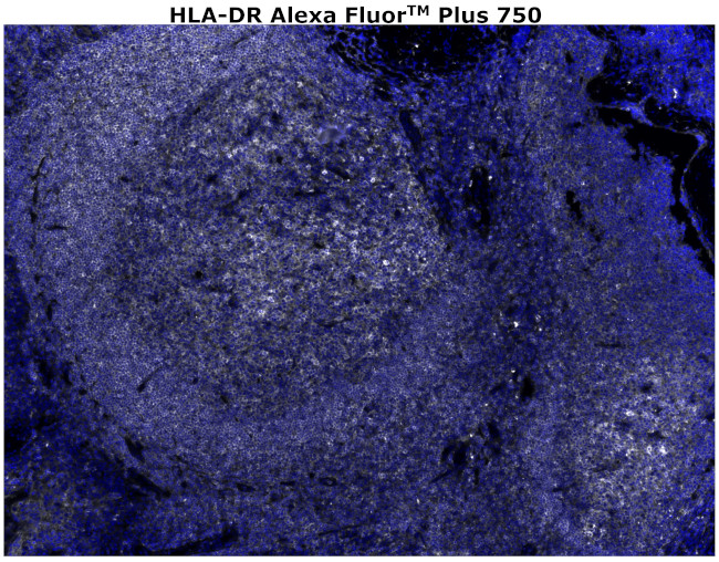 HLA-DR Antibody in Immunohistochemistry (Paraffin) (IHC (P))