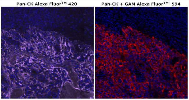 Cytokeratin Pan Type I/II Antibody in Immunohistochemistry (Paraffin) (IHC (P))