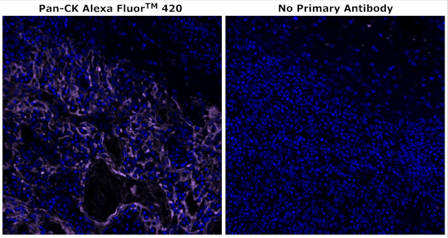 Cytokeratin Pan Type I/II Antibody in Immunohistochemistry (Paraffin) (IHC (P))