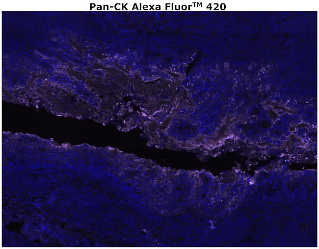 Cytokeratin Pan Type I/II Antibody in Immunohistochemistry (Paraffin) (IHC (P))