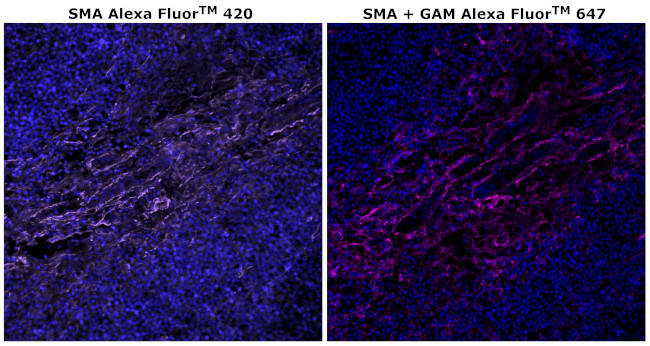 Alpha-Smooth Muscle Actin Antibody in Immunohistochemistry (Paraffin) (IHC (P))