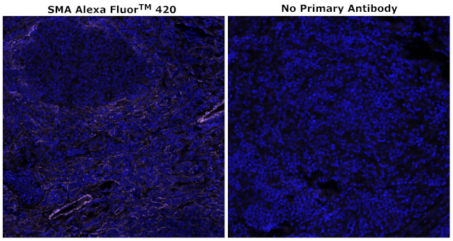 Alpha-Smooth Muscle Actin Antibody in Immunohistochemistry (Paraffin) (IHC (P))