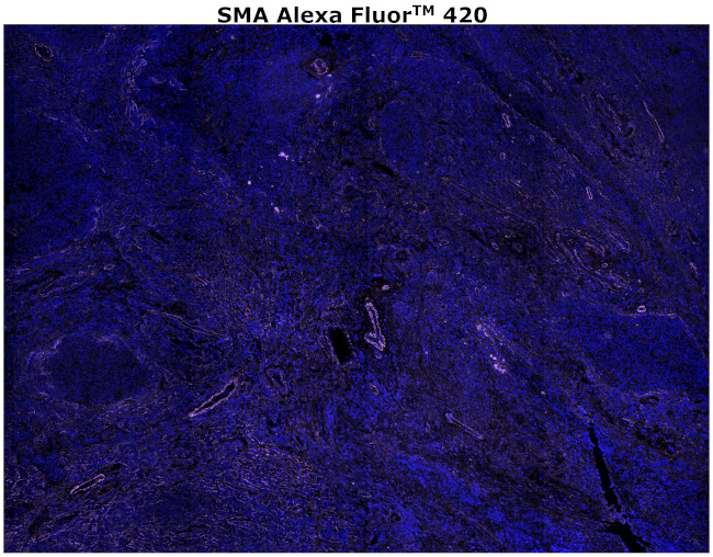 Alpha-Smooth Muscle Actin Antibody in Immunohistochemistry (Paraffin) (IHC (P))