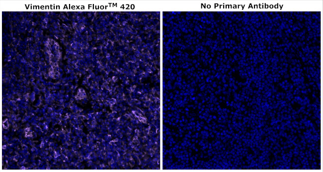 Vimentin Antibody in Immunohistochemistry (Paraffin) (IHC (P))