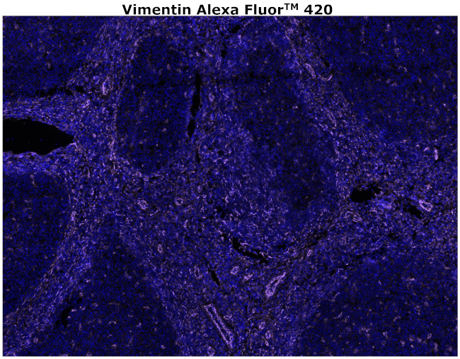 Vimentin Antibody in Immunohistochemistry (Paraffin) (IHC (P))