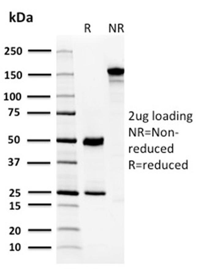 Carbonic Anhydrase VIII Antibody in SDS-PAGE (SDS-PAGE)