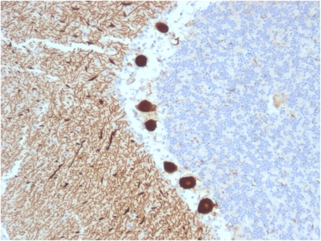 Carbonic Anhydrase VIII Antibody in Immunohistochemistry (Paraffin) (IHC (P))