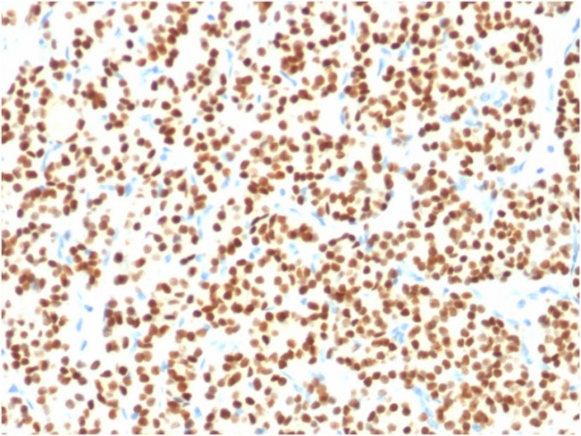 PAX8 Antibody in Immunohistochemistry (Paraffin) (IHC (P))