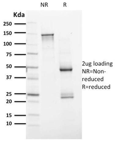 PAX8 Antibody in Peptide array (ARRAY)