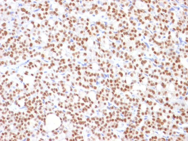 PAX8 (Renal Cell Marker) Antibody in Immunohistochemistry (Paraffin) (IHC (P))