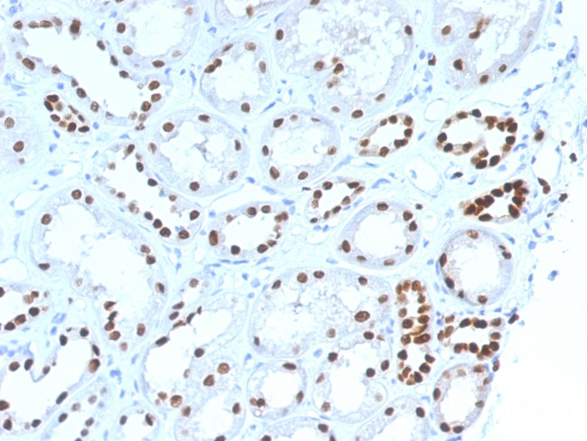 PAX8 (Renal Cell Marker) Antibody in Immunohistochemistry (Paraffin) (IHC (P))