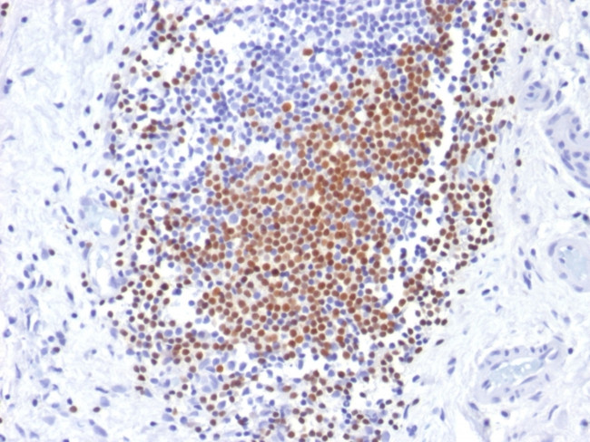 PAX8 (Renal Cell Marker) Antibody in Immunohistochemistry (Paraffin) (IHC (P))