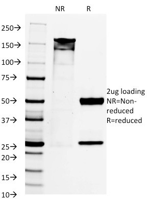 PAX8 (Renal Cell Marker) Antibody in SDS-PAGE (SDS-PAGE)