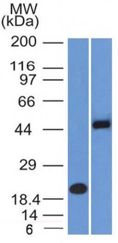 PAX8 (Renal Cell Marker) Antibody in Western Blot (WB)