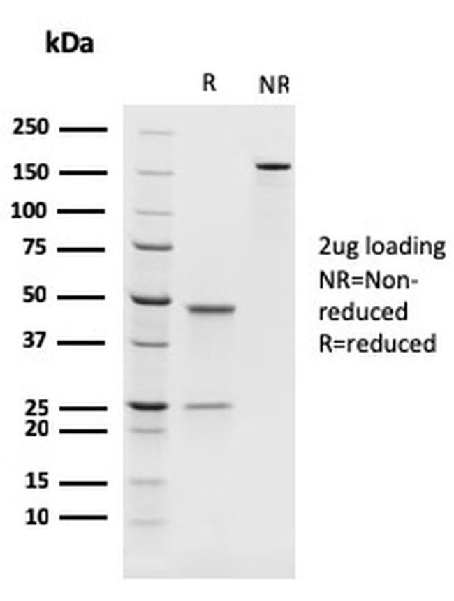 PAX8 Antibody in SDS-PAGE (SDS-PAGE)