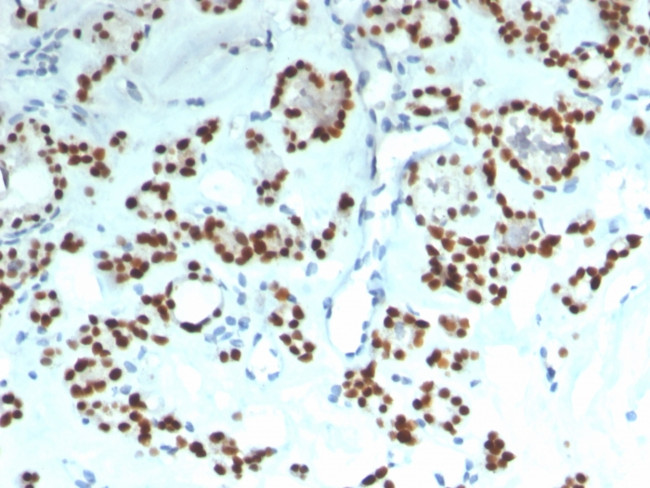 PAX8 Antibody in Immunohistochemistry (Paraffin) (IHC (P))