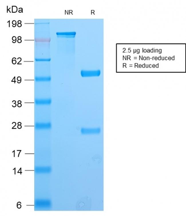 PAX8 Antibody in SDS-PAGE (SDS-PAGE)