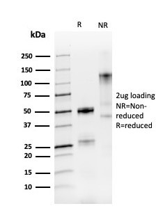 PAX8 (Renal Cell Marker) Antibody in SDS-PAGE (SDS-PAGE)