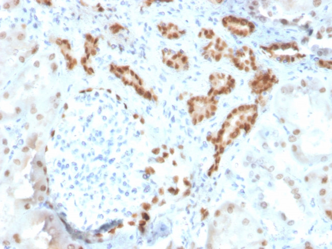 PAX8 (Renal Cell Marker) Antibody in Immunohistochemistry (Paraffin) (IHC (P))