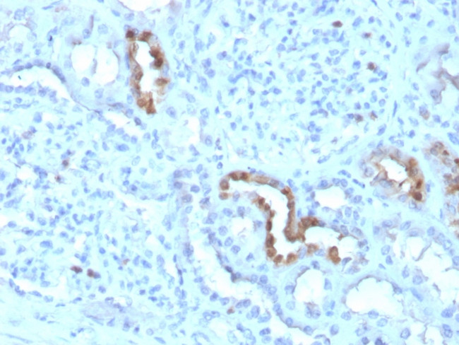 Calbindin 1 (CALB1) Antibody in Immunohistochemistry (Paraffin) (IHC (P))